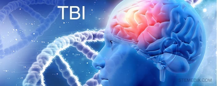 Stem Cells Improving Neurological Function Following TBI