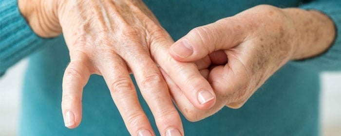 Living with Rheumatoid Arthritis