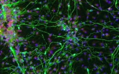 How Stem Cells May Help with Parkinson’s Disease