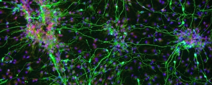 How Stem Cells May Help with Parkinson’s Disease