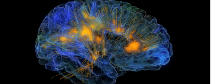 Hyperbaric Oxygen Therapy Induces Neuroplasticity in Patients with Traumatic Brain Injury