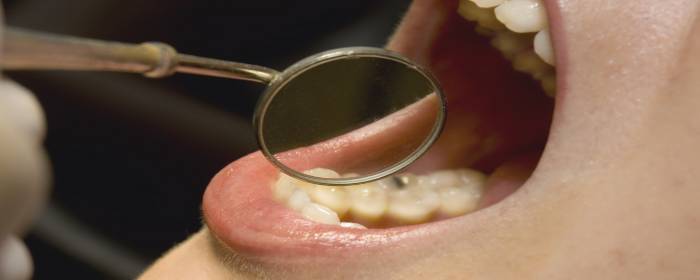 Stem Cells Show Promise for Treating Oral Disease