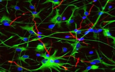 Stem Cell Secretomes for Brain Repair