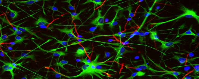 Stem Cell Secretomes for Brain Repair