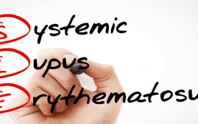 Mesenchymal Stem Cells Help Patients with Severe Systemic Lupus Erythematosus