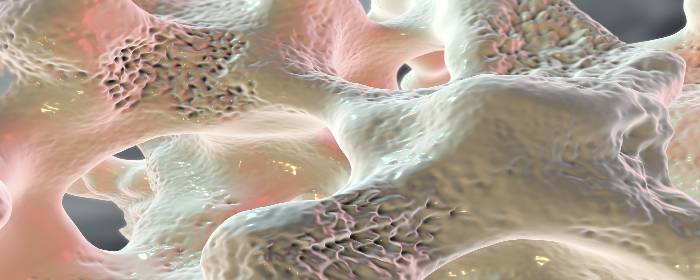 Stem Cells from Elderly Patients Can Form New Bone