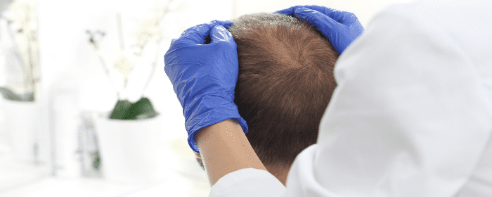 How Does Stem Cell Hair Restoration Work