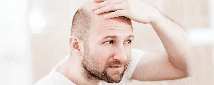 Stem Cell Therapy for Hair Loss