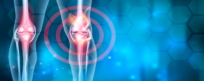 Exosomes from Mesenchymal Stem Cells Show to Protect Cartilage and Relieve Osteoarthritis Pain