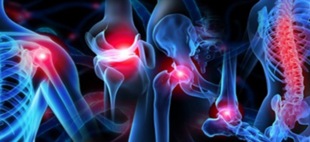 Can Stem Cells Help Manage Chronic Orthopedic Problems?