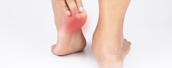 Plantar Fasciitis Stretches to Soothe Heel Pain