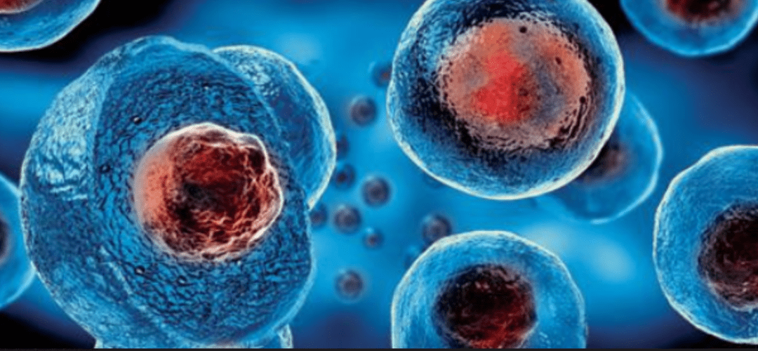 Stem Cell Therapy For Amyotrophic Lateral Sclerosis