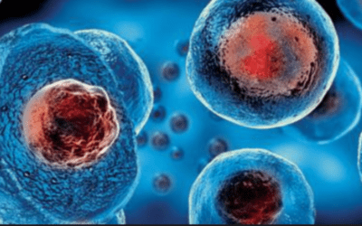 Stem Cell Therapy For Amyotrophic Lateral Sclerosis