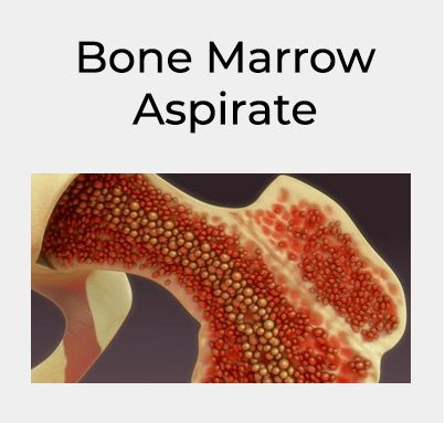 bone-marrow-aspirate-square