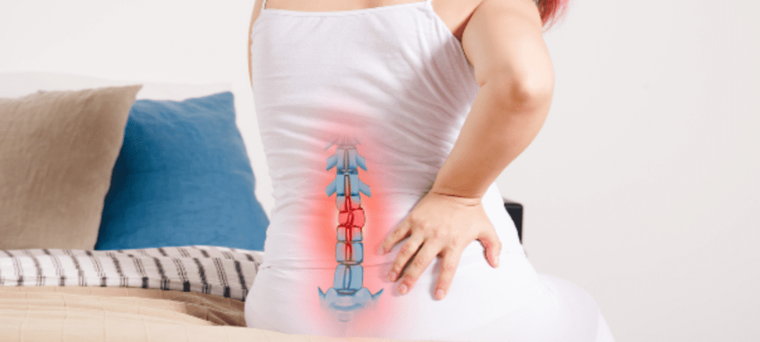 How to Manage Herniated Disc Pain