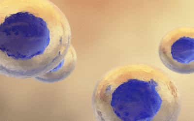 Stem Cells For Autoimmune Diseases: MSCs
