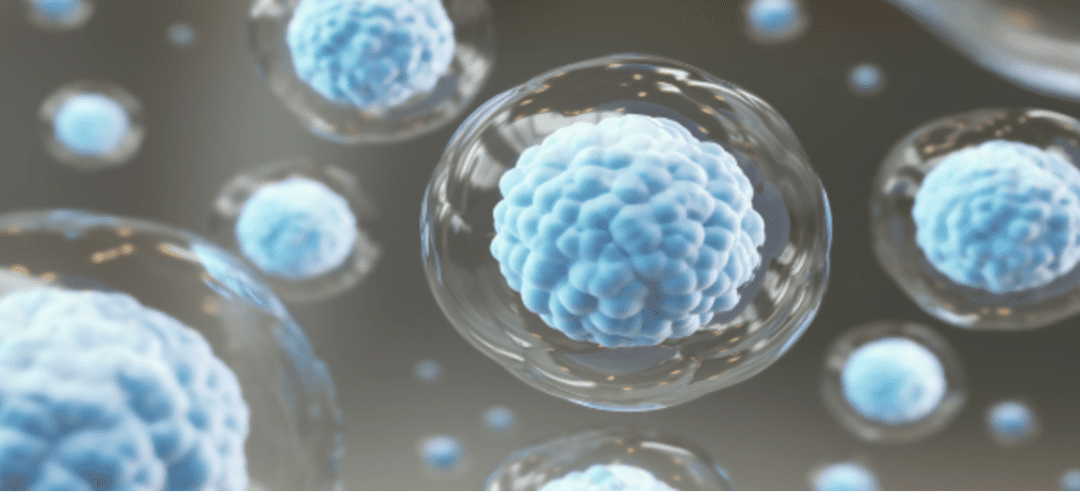 Mesenchymal Stem Cell Therapy for Parkinson’s Disease