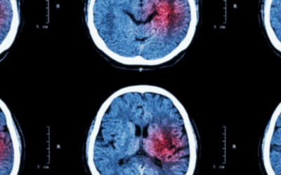 Can Stem Cells Help Brain Injury?