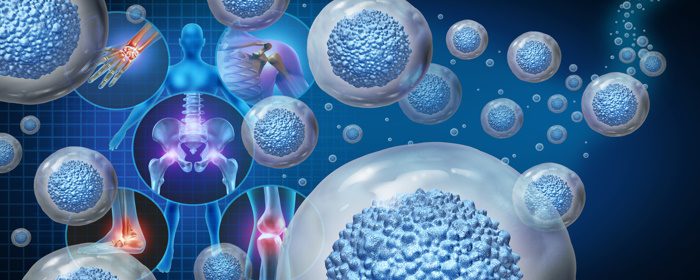 Mesenchymal Stem Cells and Osteoarthritis