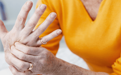 Things You Can Do to Help Hand Arthritis