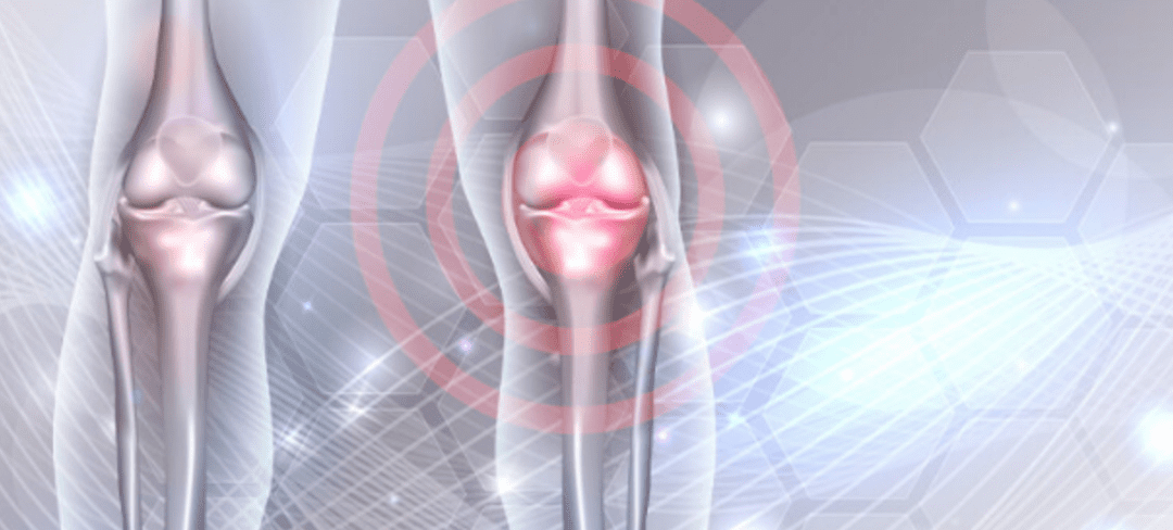 How Long Does Stem Cell Therapy Last for Knees