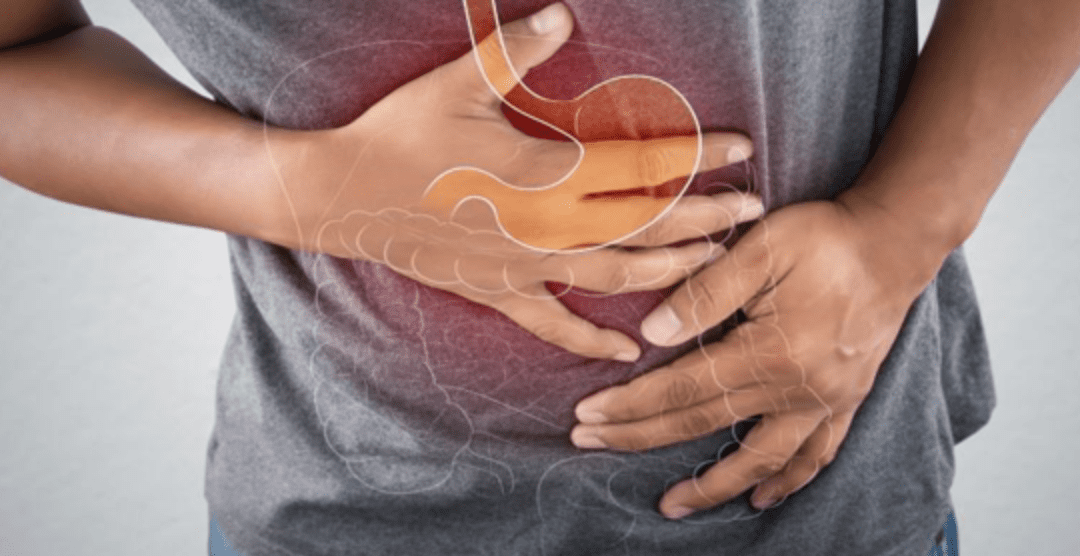 What Is Crohn’s Disease?