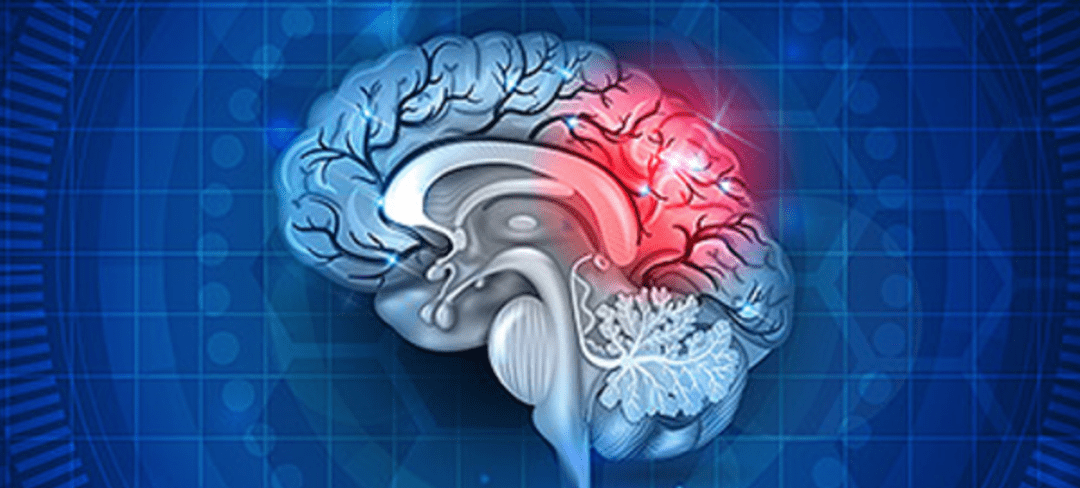 Symptoms of Brain Injury from Car Accident