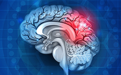 Symptoms of Brain Injury from Car Accident