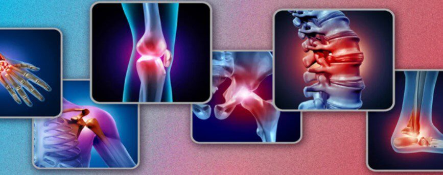 Best Pain Management Treatments for Osteoarthritis