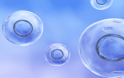 Mesenchymal Stem Cell-Derived Neural Progenitors in Progressive MS