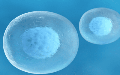 Clinical Application of Mesenchymal Stem Cells in Autoimmune Conditions