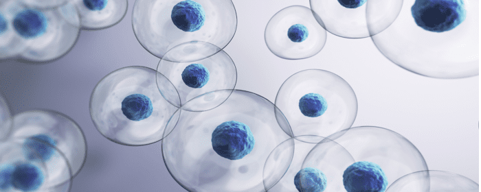 Adipose-Derived Stem Cells: A Promising New Approach for Treating Secondary-Progressive Multiple Sclerosis