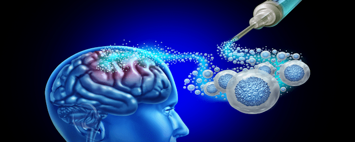 Exploring the Promise of Neural Stem Cells in Treating Neurological Diseases