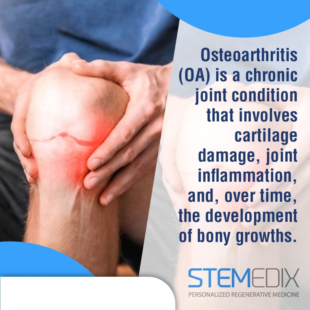 Osteoarthritis vs. aging with stem cell therapy benefits