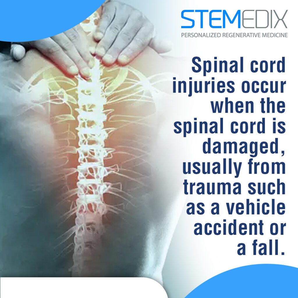 Role of Stem Cell Therapy in Recovery