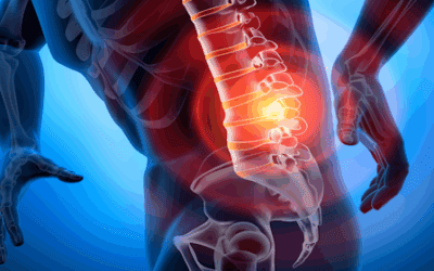 Fibrin Sealant Injections: A Promising Regenerative Approach for Chronic Low Back Pain