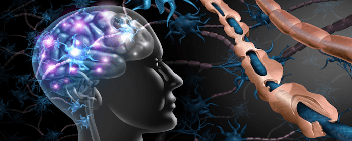 Neural Stem Cell Therapy: A New Hope for Progressive Multiple Sclerosis