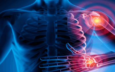Mesenchymal Stem Cell Therapy for Rheumatic Diseases