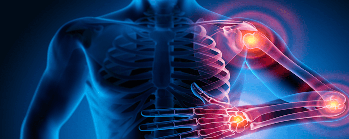 Mesenchymal Stem Cell Therapy for Rheumatic Diseases