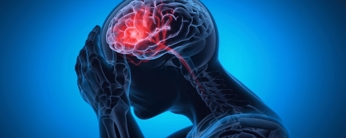 Exploring Stem Cell-Based Treatments for Traumatic Brain Injury Recovery