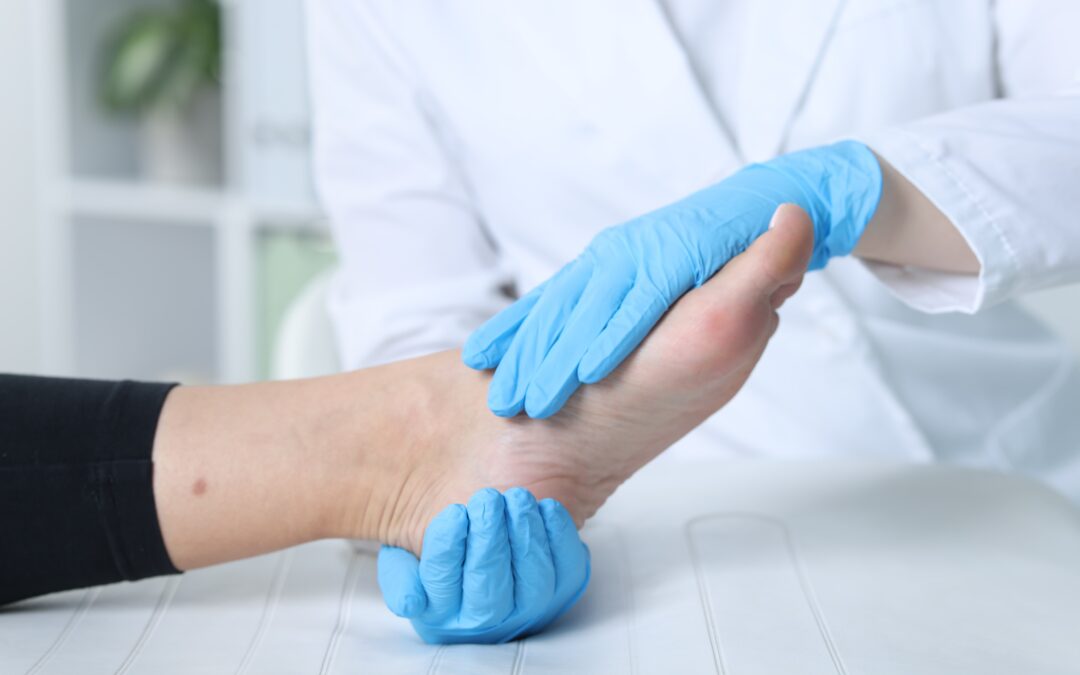 Medical professional wearing blue gloves examining a patient’s foot during a clinical check for diabetic neuropathy, circulation problems, or foot pain.